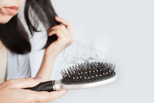 Mengenal Alopecia Areata, Penyakit Autoimun Penyebab Rambut Rontok