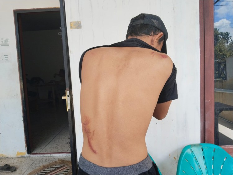 Diduga Libatkan Oknum ASN RSUD Djasamen Saragih, Warga Sitalasari Dikeroyok Brutal di Depan Rumah