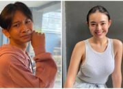 fajar sadboy kecelakaan motor, amanda manopo ungkap kondisi tangannya