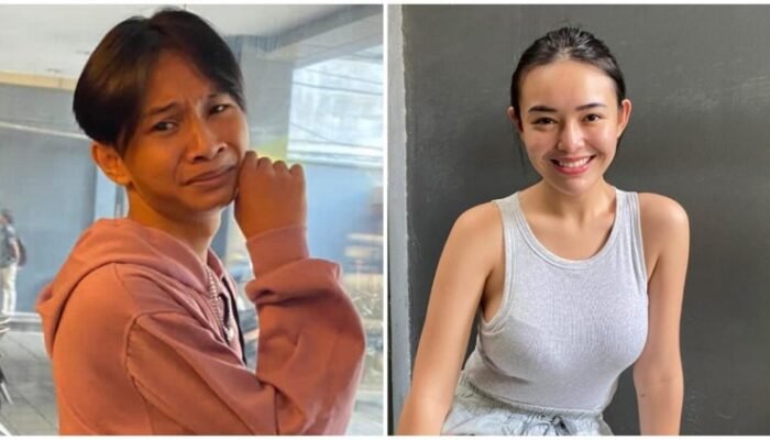 fajar sadboy kecelakaan motor, amanda manopo ungkap kondisi tangannya
