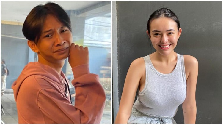 Fajar Sadboy Kecelakaan Motor, Amanda Manopo Ungkap Kondisi Tangannya