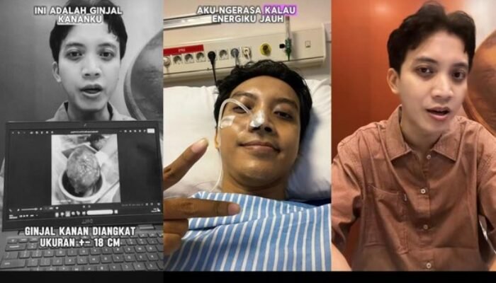 kisah pria surabaya kena kanker ginjal di usia 35, awalnya hanya nyeri perut hingga harus angkat ginjal